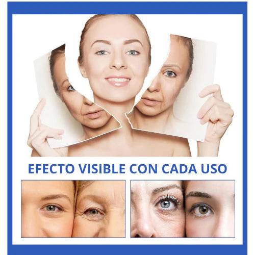 Botox Stock Solution - Suero Antiarrugas ✨