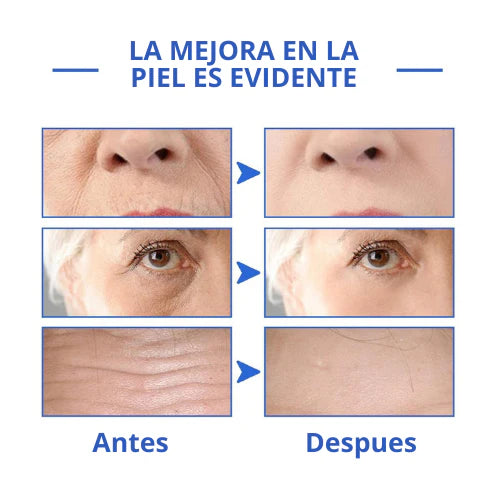 Botox Stock Solution - Suero Antiarrugas ✨